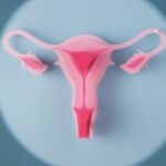 Wat zijn baarmoederpoliepen?