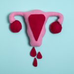 Dít zijn de aan menstruatie gerelateerde aandoeningen