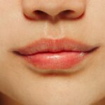 10 tips tegen gesprongen lippen