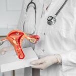 Doorbraak in behandeling endometriose dankzij Australische wetenschappers