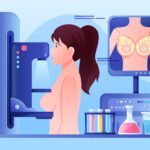 Borstkanker: hoe kan het niet te zien zijn op een mammografie?